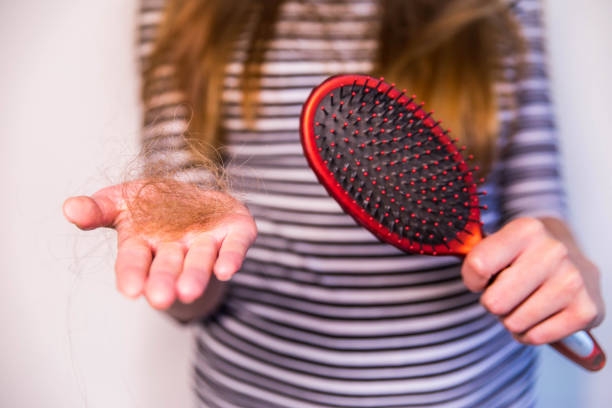 6 Reasons Why your Hairpiece is Shedding and How to Avoid it